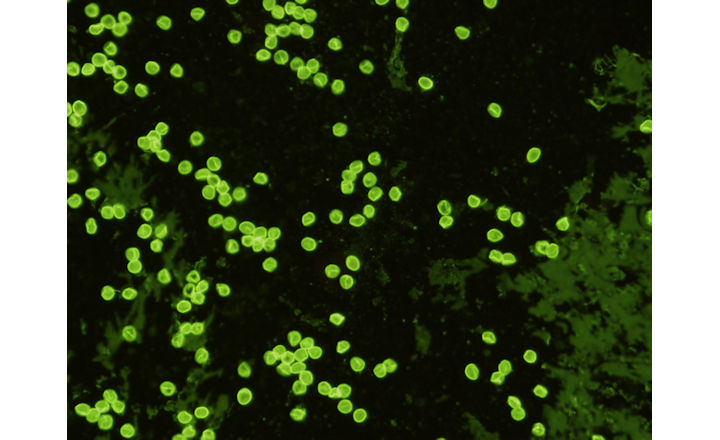 New <em>Cryptosporidium parvum </em>Monoclonal Antibodies Available