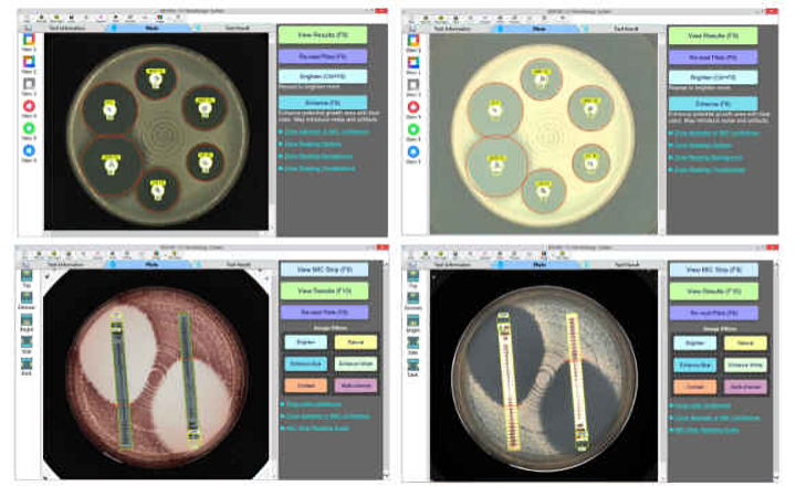 New BIOMIC V3 Optical System Delivers Higher Image Resolution