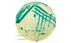 Chromatic VRE Screens Direct From Patient Samples