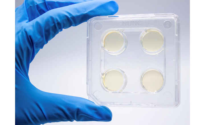 Easy Dermatophyte Testing: Derma-SR-Screen for Terbinafine and Itraconazole Susceptibility